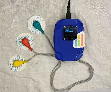 Arduino based ECG (Electrocardiogram) signal analyzer - Open-Electronics